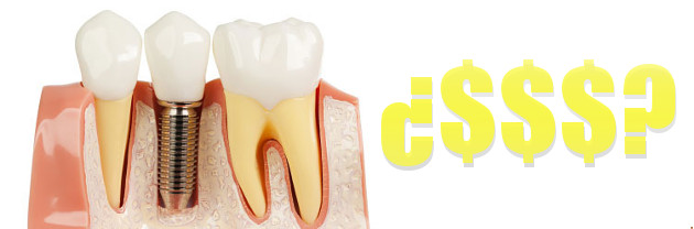 Coste implante dental
